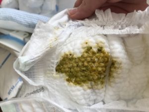 Ребенок покакал зеленым калом