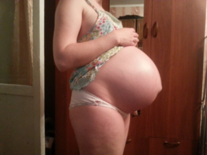 Беременность 38 недель чешусь