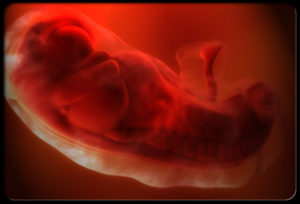 4 Недели беременности колит бок