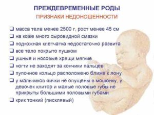 Признаки преждевременных родов 34 неделе
