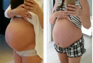 Опустился живот на 28 неделе беременности