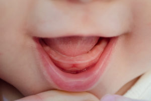 Во сколько месяцев первые зубки лезут