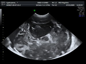 4 Недели беременности колит бок