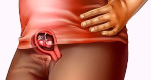 Беременность 8 недель знобит