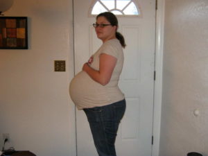 35 Неделя беременности двойней форум