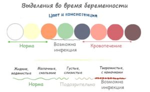 26 Неделя беременности выделения норма