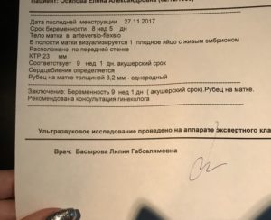 Срок беременности по узи и акушерский
