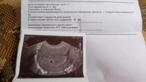Месячные 2 3 недели беременности