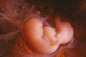 Эмбриональная 4 неделя беременности