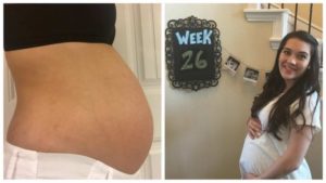 26 Неделя беременности двойней