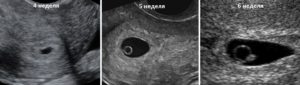 Размер эмбриона 2 недели зачатия