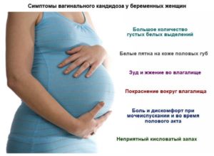 4 Неделя беременности молочница