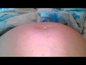 Беременность 38 недель чешусь