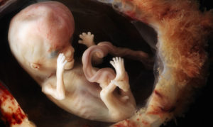 Эмбрион 2 недели от зачатия