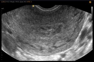 Беременность 2 недели что делать
