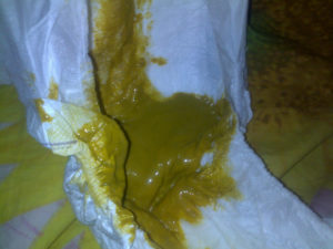 Ребенок покакал зеленым калом