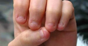 Причины ребенок грызет ногти