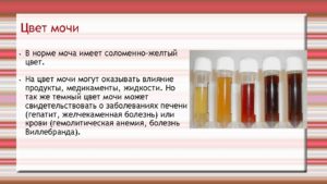 Цвет мочи ребенка в норме