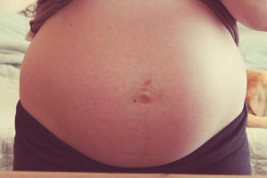 Болит пупок 7 неделя беременности