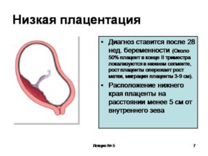 Низкая плацента беременности 15 недель