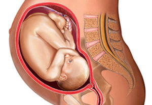 Низкая плацента 21 неделе беременности