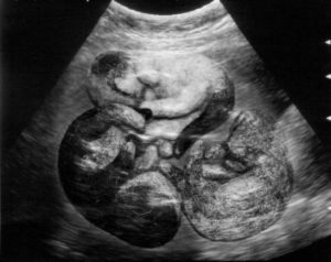 Беременность кошки 8 недель