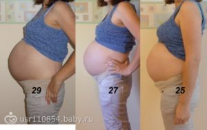 27 Неделя беременности близнецами
