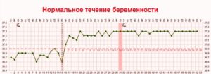 Температура 6 неделя беременности норма