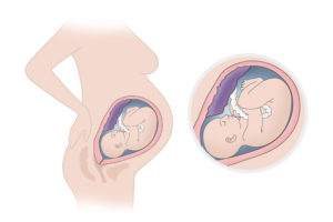 Ноет низ живота на 33 неделе беременности