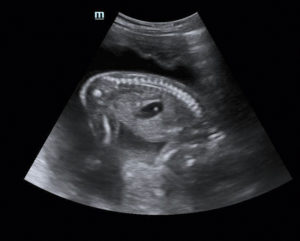 Узи в 3 триместре на какой неделе