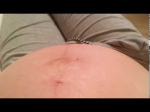 Икота 35 неделе беременности
