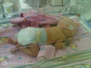 Роды в 35 36 недель беременности