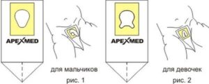 Как взять у ребенка мочу на анализ?