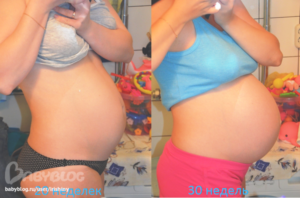 31 Неделя беременности болит спина