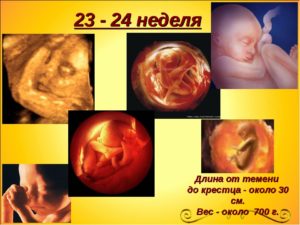 23 неделя беременности акушерская