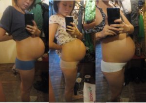 17 Недель беременности каменеет живот