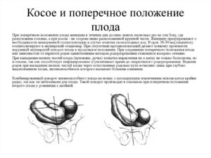 Поперечное положение плода 31 неделю