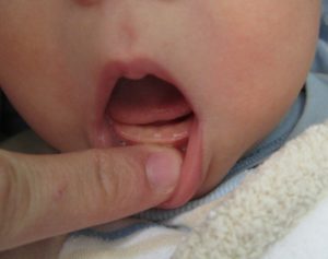 Во сколько режутся первые зубки у детей