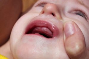 Во сколько у девочек начинают резаться зубки