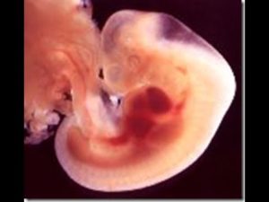 3 5 4 Недели беременности