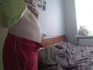 Колит живот 11 неделя беременности