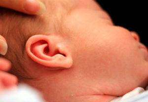 За ушами у новорожденного