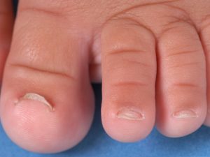 Причины ребенок грызет ногти