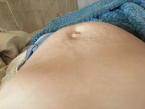 27 Недель беременности боль промежности
