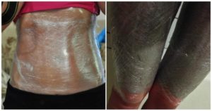 Жиросжигающие обертывания для ног в домашних условиях