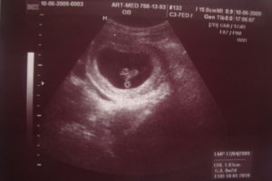 Срок 7 недель беременности коричневые выделения