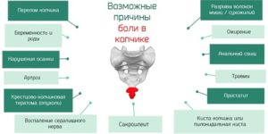 Беременность 19 недель болит копчик