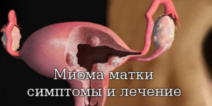 Миома матки 11 недель что делать