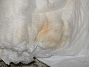 Третья неделя беременности мажущие выделения