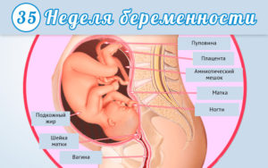 33 Неделя беременности болит голова